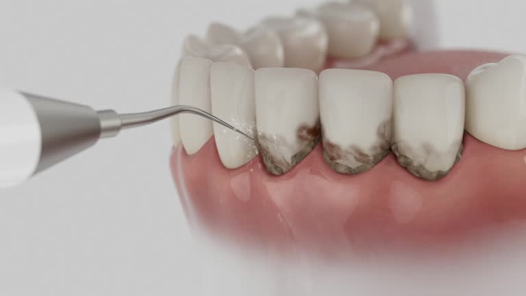 Trusted Wisdom Tooth Removal service in Centerville, GA - Dentist Open Now